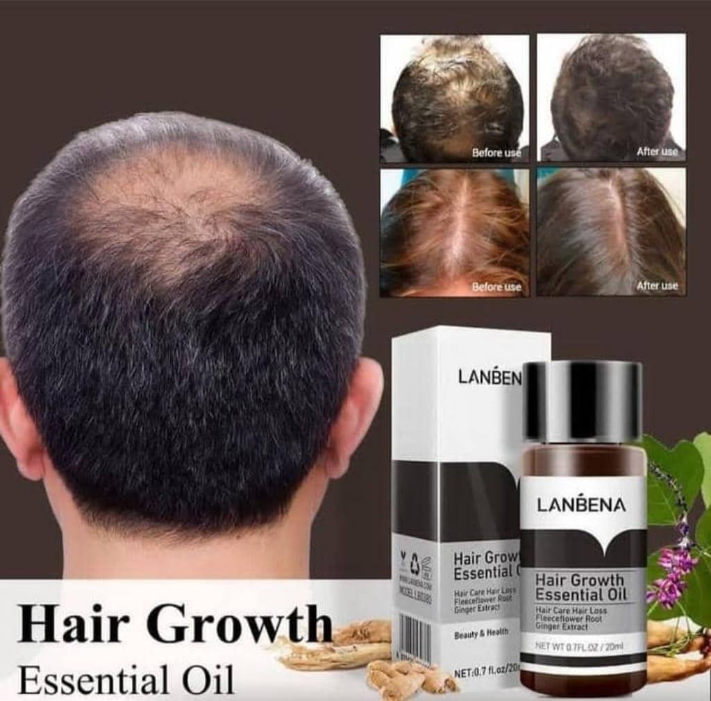 روغن و محلول تقویت مو بسیار قوی لانبنا اصلی حجم ۲۰ میل